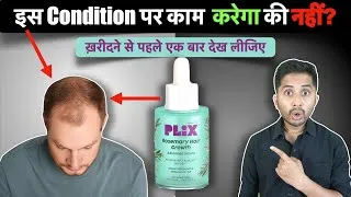 Thumbnail: Plix Rosemary Hair Growth Serum Review - Will it Control Hair Fall?