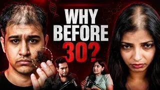 Thumbnail: Why are Indians are Losing Hair Before 30