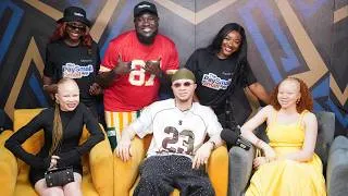 Thumbnail: What It’s REALLY Like Living With Albinism in Nigeria | The Honest Bunch Podcast