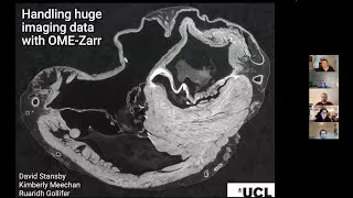 Thumbnail: Handling huge imaging data with OME-Zarr