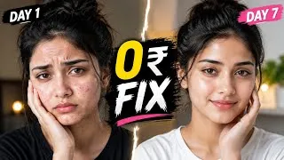 Thumbnail: Remove Pimple Marks in 7 Days (0 ₹) | Every Girl Must Watch | #skincare #glowup #viral 