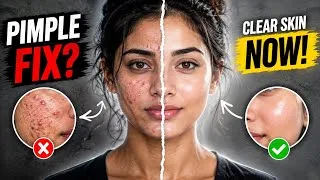 Thumbnail: How to Reduce Pimples Naturally | Simple 7-Day Skincare Routine | #pimple #skincare #glowup 