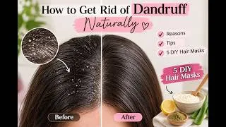 Thumbnail: DIY Hair Masks to Finally Ditch Dandruff ✨