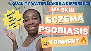 Thumbnail: 🥰Changing your water is essential to support better skin & hair health 🚿Anespa Dx. Learn more 👌✨️