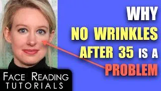 Thumbnail: Why No Wrinkles After 35 Is Problematic