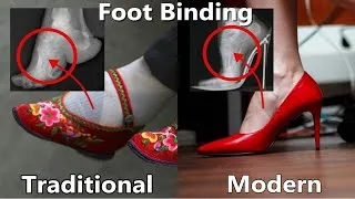Thumbnail: Are We still Foot Binding?!