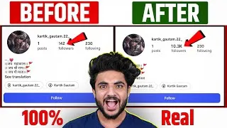 Thumbnail: 🎯Instagram Follower Kaise Badhaye | Instagram Par Followers Kaise Badhaye | Free Instagram Followers