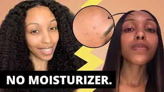 Thumbnail: No Butters, No facial Oils, No Moisturizer for Clear Skin?? | Fungal Acne Prone Textured Skin
