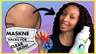 Thumbnail: *NEW* Maskne hacks that will save your skin! [get rid of mask acne]