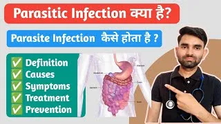 Thumbnail: Parasitic Infection in Hindi | Causes, Symptoms, Prevention And Treatment of Parasite Infection