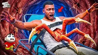 Thumbnail: Franklin And Shinchan Found a MONSTER Inside Franklin's Body in GTA 5! Bangla Gameplay