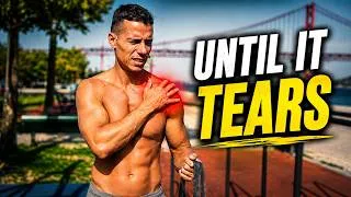 Thumbnail: Most People Ignore Their Rotator Cuff Until It Tears