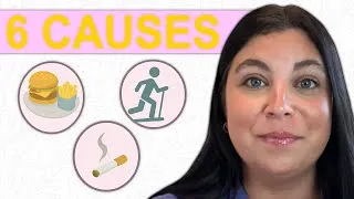 Thumbnail: 6 Lifestyle Factors Causing Irregular Periods