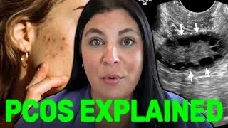 Thumbnail: PCOS Explained: What It Is, Symptoms & How It's Diagnosed