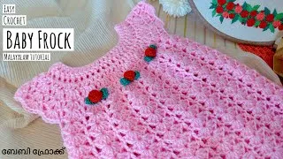 Thumbnail: 🔥😍നിങ്ങൾ ചോദിച്ച EASY Crochet BABY FROCK Malayalam Tutorial for beginners | Crochet Baby dress