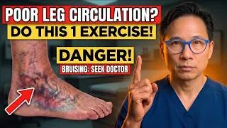 Thumbnail: Surgeon Reveals  The #1 Exercise to Improve Leg Circulation After 60