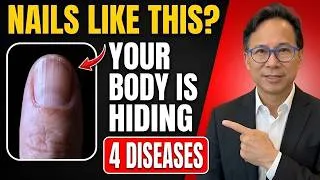 Thumbnail: Neurologist Explains_ If Your NAILS Look Like THIS After 60, Your Body Can be Hiding 4 Diseases