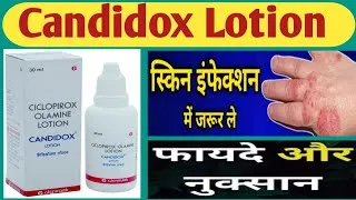 Thumbnail: Candidox Lotion Uses |   Fungul infection दाद खाज खुजली को जड़ से खत्म करें | Skin infection | 
