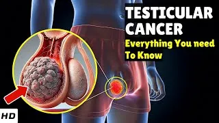 Thumbnail: Testicular Cancer Explained: Causes, How to Spot It Early, Diagnosis & Best Treatment Options!
