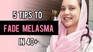 Thumbnail: 5 Practical Tips to Fade Melasma After 40