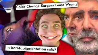 Thumbnail: Evil Eye Color Surgery