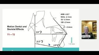 Thumbnail: Dr Risinger: How to Make Class II and Class III Correction Simple and Predictable