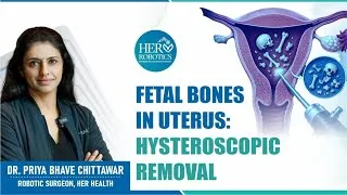 Thumbnail: Fetal bones in uterus: Hysteroscopic removal
