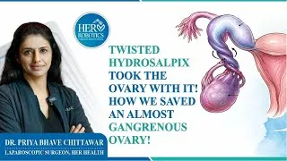Thumbnail: Twisted Hydrosalpix took the ovary with it! How we saved an almost gangrenous ovary!