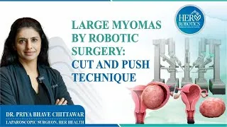 Thumbnail: A giant fibroid. A precise robotic technique. Minimal trauma.