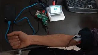 Thumbnail: MuscleScroll:EMG-Powered Tab Navigation on Raspberry Pi 🔺🔻