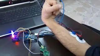 Thumbnail: Hexabitz EXG Biosignal Processing & Visualization in Arduino