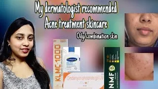 Thumbnail: 20 Days Mein Acne Gayab? Dermatologist Ne Mujhe Kya Diya 😳| Isotretinoin and erytop Journey 😱