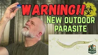 Thumbnail: There’s A New Parasite in the Backcountry & I Have It… (You Won’t Believe This)