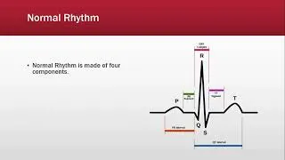 Thumbnail: EKG Rhythm | EKG Interpretation Clip