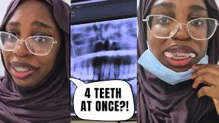 Thumbnail: ​4 Teeth Pulled for Braces! London Extraction Vlog, Tea Party & Baby’s 1st Jumu'ah | Week in my life