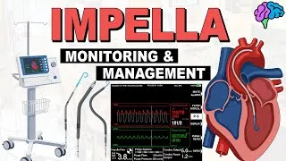 Thumbnail: Monitoring & Management of the Impella and Patient