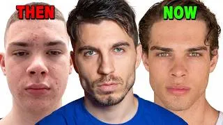 Thumbnail: Yall Are Just Ugly