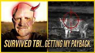 Thumbnail: Missing Part Of My Skull... Now I Take Theirs