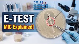 Thumbnail: E-test (Epsilometer Test) Made Easy | Principle, Procedure & MIC Interpretation
