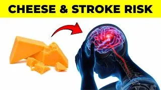 Thumbnail: What Nobody Tells You About Cheese and Stroke Risk (Science Explained)