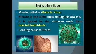 Thumbnail: Measles Virus, Pathogenesis, symptoms, structure