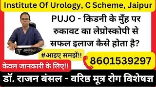 Thumbnail: What is PUJ Obstruction? - किडनी के मुंह पर रुकावट | Laparoscopic Pyeloplasty Treatment in Hindi