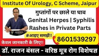 Thumbnail: गुप्तांगों पर छाले या घाव| Genital Herpes | Syphilis | Genital rashes STDs | Diagnosis & Treatment