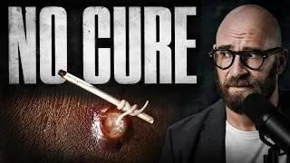Thumbnail: Guinea Worm Disease