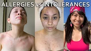 Thumbnail: How to Know if you Have Food Allergies or Food Intolerances