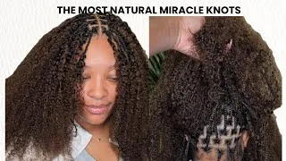 Thumbnail: How I Make Miracle Knots Look Like REAL Hair! 