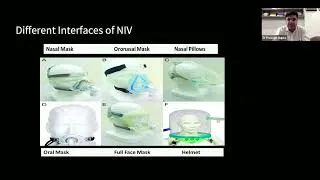Thumbnail: STEP N Session : Non Invasive Ventilation