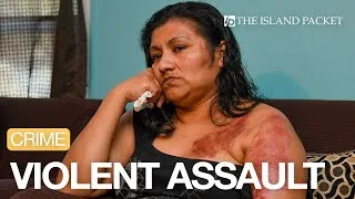 Thumbnail: SC Woman Robbed & Doused With Chemical In Terrifying Knife Attack