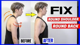 Thumbnail: HOW: FIX Round Shoulder & Round Back in 1 week | 七天見效 告別虎背熊腰