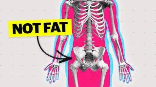 Thumbnail: The truth about what you lose with rapid weight loss
